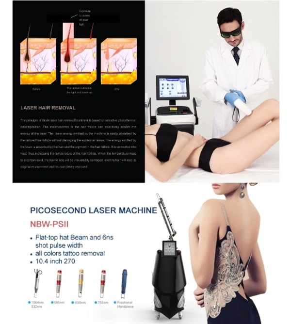 Nubway Laser Machine